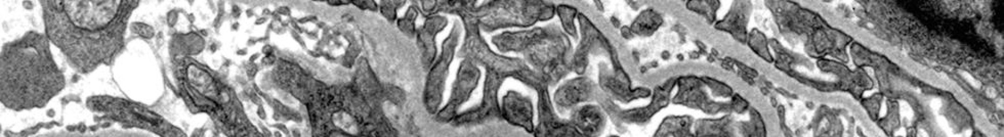 Electron Microscopy